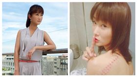 一家人,陳珮騏,疤痕（合成圖／翻攝自陳珮騏臉書）