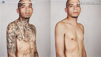 神奇！刺青去除讓黑幫再現原始面貌