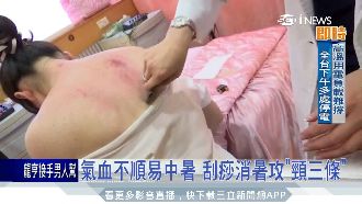 消暑攻「頸三條」　這樣刮痧效果最好