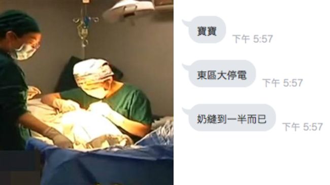 奶縫到一半遇停電！網友：大小奶怎辦