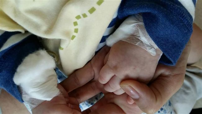 寶寶抽血瘀青滿布　母嗆醫護「無良」