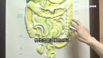 停電「大腸鏡剛插進」　復電再做一次