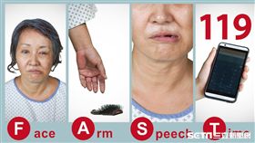 中風辨識徵兆「FAST」。（圖／新北市衛生局提供）