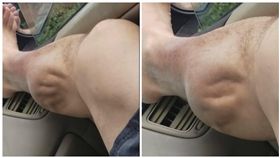 美國,男子,小腿抽筋,肌肉抽搐（圖／翻攝自Angel Bermudez臉書）