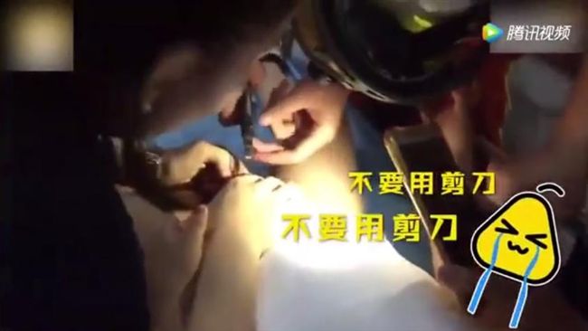 雞雞卡拉鍊出動剪刀　男童泣：不可以