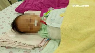 男嬰慘遭母同居人毒打　頭部骨折命危