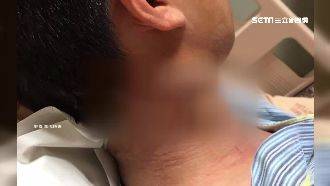 府憲兵遇襲　右頸部刀傷照獨家曝光！