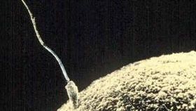 精子（圖／翻攝自維基百科）