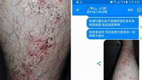 足體館,按摩,舒壓,化膿,發炎,痘痘,毛囊,醫藥費,小腿,乳液（圖／翻攝自爆料公社）
https://www.facebook.com/photo.php?fbid=1886786934972695&set=pcb.1370748146390680&type=3&theater