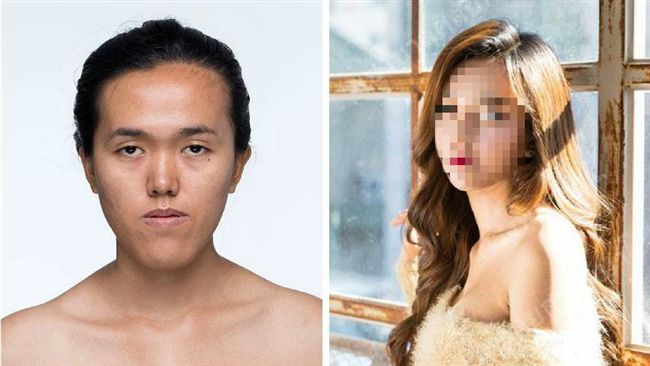 「想有正常人的臉」戽斗女整形變女神