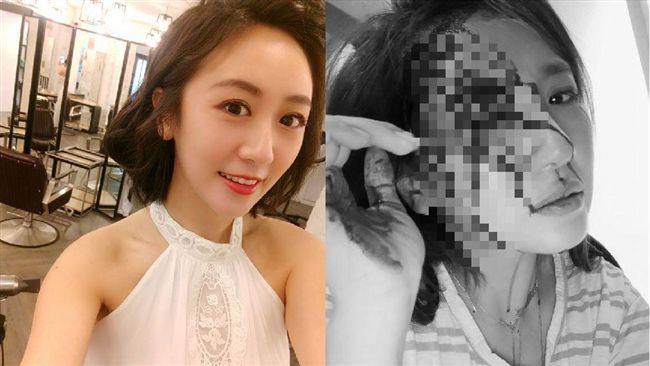 女星半夜慘遭爆頭　「眼前只看到血」