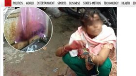 印度,少年,少女,女學生,砍殺,斷手（圖／翻攝自indiasamvad.co.in）
http://www.indiasamvad.co.in/states-metros/stalker-chops-off-minor-hand-in-lakhimpur-in-up-23876