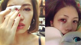 疑種族歧視！台女紐約街頭遭黑人毆傷