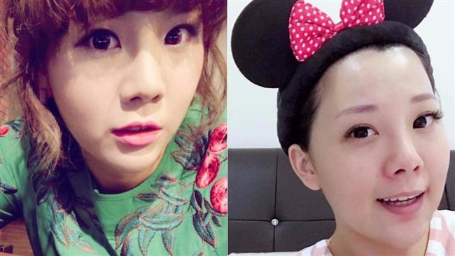 女星患病突暴肥！　減肥引敗血症入院