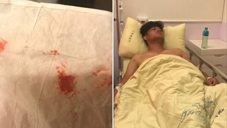 謝淑薇轟詹詠然退賽：我弟咳血仍備戰