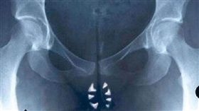 陰牙人,陰道,牙齒,成熟型畸胎瘤,細胞,毛髮,卵巢
（圖／翻攝自電影《陰牙人》海報）