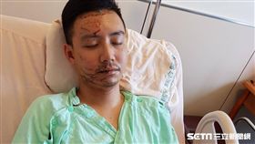 開刀完縫400針靠嗎啡止痛　受傷國道警楊于辰首度露面：我很好。
