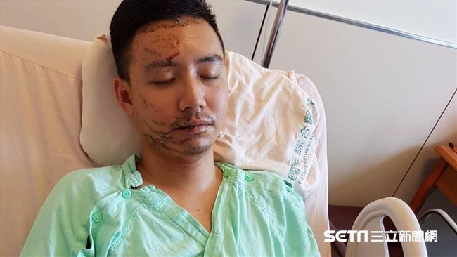 「活著就是幸福」　國道倖存警出院了