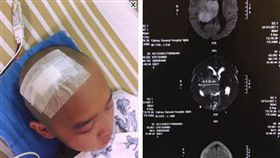 腦癌倒下！9歲女兒笑剃光頭「我會好起來」…劉士毅賣房籌錢(圖/翻攝自劉士毅臉書)