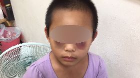 桃園女童疑受虐　檢警追查（1）