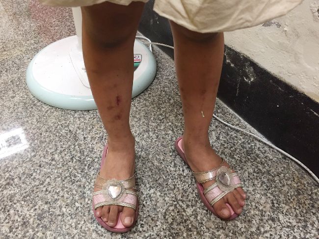 5歲女童頭髮遭剃光　惡老闆遭警傳訊