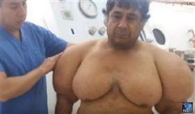 秘魯,漁夫,馬丁內斯,Alejandro Ramos Martinez,減壓症（圖／翻攝自《PatrynWorldLatestNew》YouTube