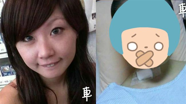車禍毀容　嫩妹發勸世文：不要酒駕