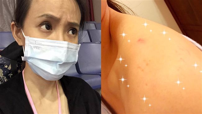 肩膀驚見咬痕！女星控：我被家暴了