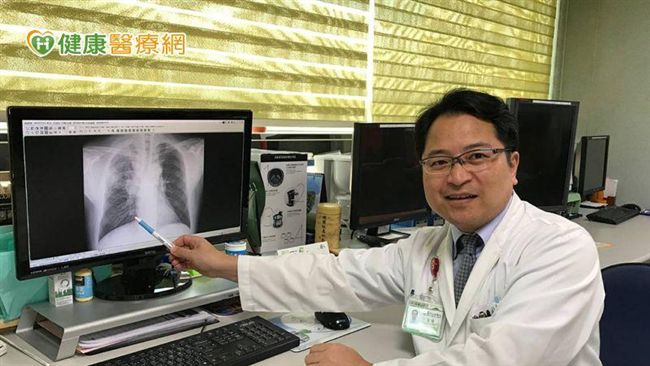 用藥成效不彰　肺癌治療應全面性考量