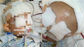 2歲童玩拋接慘摔　頭部重創陷昏迷（組圖／翻攝畫面）
