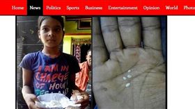印度,少女,棉花淚（圖／翻攝自myjoyonline） https://www.myjoyonline.com/news/2017/September-13th/indian-girl-allegedly-has-cotton-tears-oozing-from-her-eyes-every-day.php
