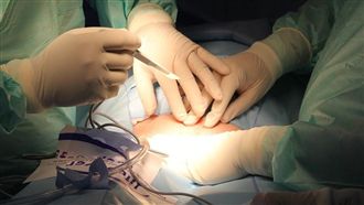 開刀房書記報假帳！3年A走316萬