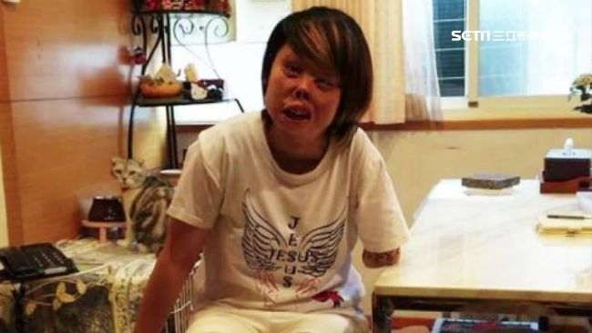 癌末母陪重殘愛女義跑　齊募舊鞋助人