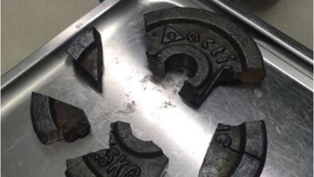 怎麼練的？男子生殖器竟卡在槓片上