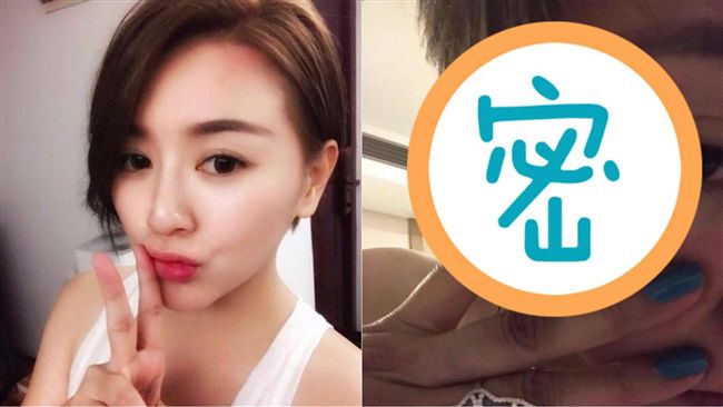 李妍憬不慎跌落山谷　毀容傷照曝光！