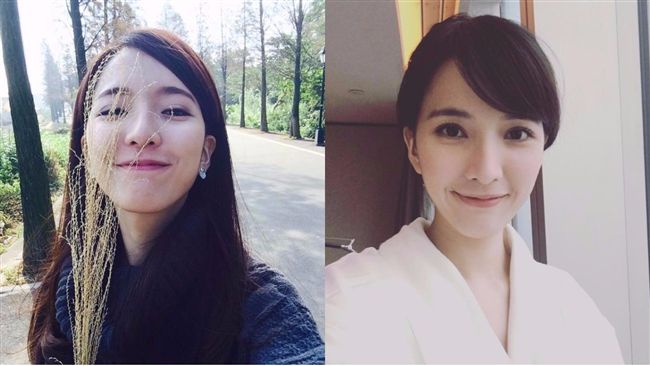 女星臉長膿包　遭醫警告恐臉穿孔