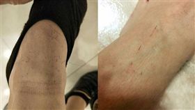 頭髮,剪髮,美髮師,發炎,皮膚,腳背,毛孔（圖／翻攝自爆廢公社）