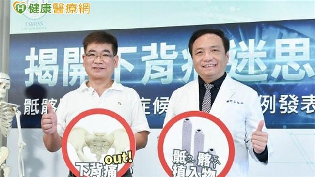 下背痛20年　原來是骶髂關節疼痛