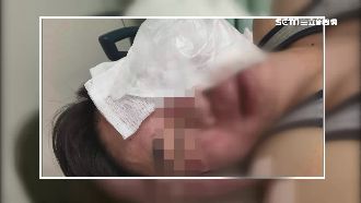 「洗太久」爆衝突！男子遭痛毆恐失明