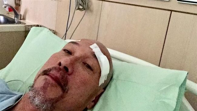 恭喜！黃仲崑開腦成功曬光頭照報喜