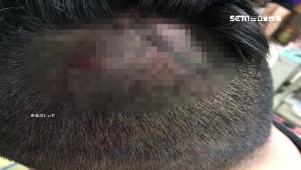 黑衣人隨機痛毆　音樂會染血6人受傷