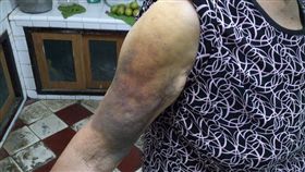 柚子,臉書,吳元宏,Hsi-Yu Yu,Wikipedia,維基百科,抗凝血劑,藥物,肝臟酵素,死亡風險　圖／翻攝自吳元宏臉書　https://goo.gl/CgK7hG