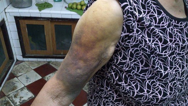 中秋「這樣」吃柚子！小心死神伴身邊