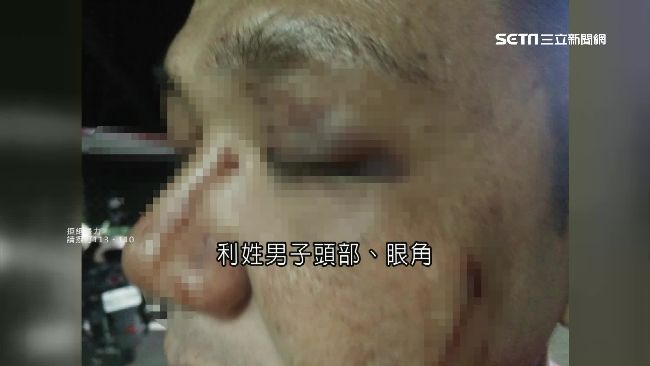 男控鄉代偕子圍毆　反遭嗆惡人先告狀