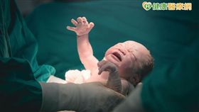 腹膜外生產一定好？　醫：潛藏三大風險