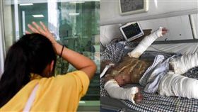 男友燒燙傷女友不離不棄／翻攝自微博