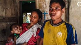 印度有一名28歲的男子Neirbanglal Kaipeng，育有一位2歲男童朱利安（Jailian Kaipeng），某日他的兒子眼睛突然變形腫脹（圖／翻自《CAP TV》YouTube）
