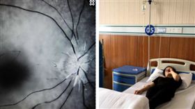 連假整天沉迷手遊　大陸OL右眼忽然一片黑(圖/翻攝自東莞陽光網)