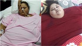 Eman Ahmed,埃及,孟買,體重,最胖,Saifee,腹腔鏡縮胃,象皮病　圖／翻攝自鏡報　