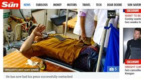 印度,伊薩德,Irshad,遭砍生殖器（圖／翻攝自太陽報）
https://www.thesun.co.uk/news/4622262/man-penis-reattached-mistress-cut-off-discovered-engaged/